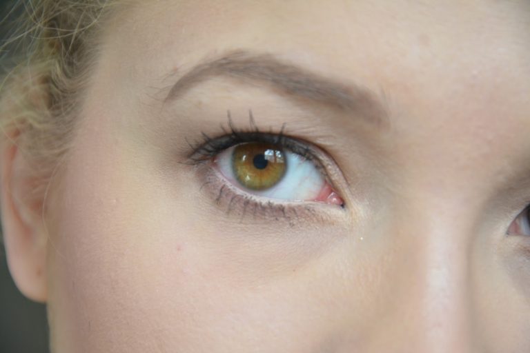 Lentilles : pour quelles contributions ?