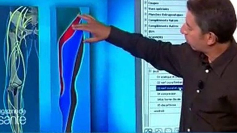 Hernie crurale : Connaissez-vous les différentes explications que l’on peut donner à la hernie crurale ?